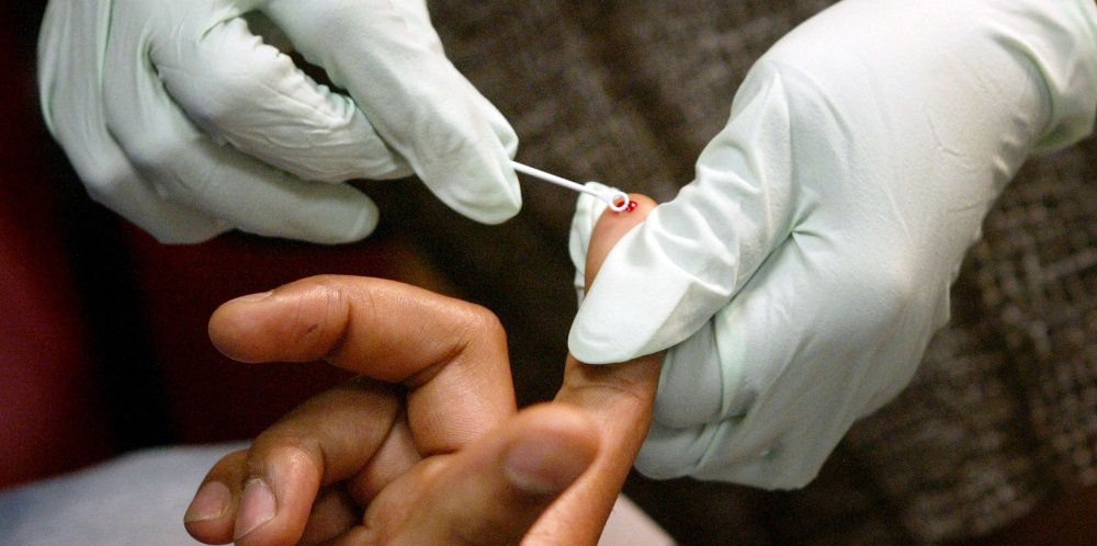 hiv-blood-test