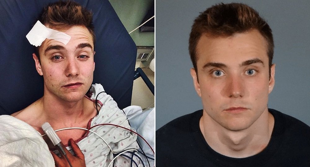 On the left: the photo McSWiggan uploaded to Instagram after the alleged "hate crime". On the right, McSwiggan's police booking photo, which police say was taken after the photo from hospital and shows no visible injuries.