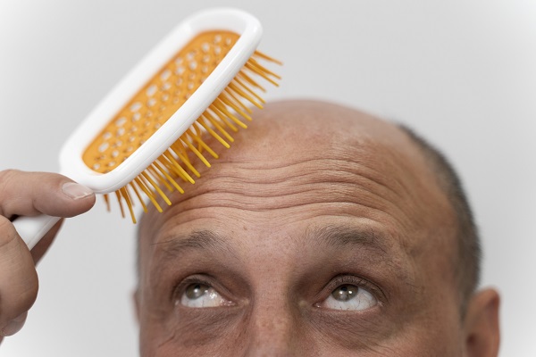 The Capil Clinic is one practice in Turkey offering hair transplants