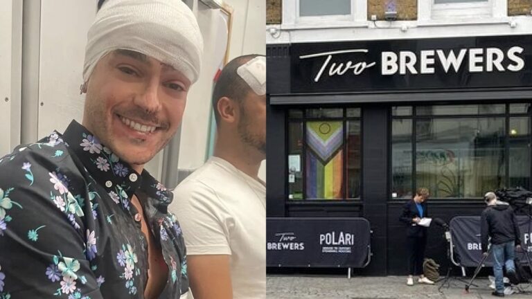 One of the victims of the attack outside the Two Brewers in Clapham has spoken out