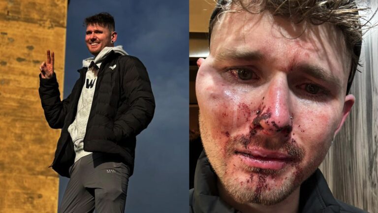 Lewis North was attacked in a homophobic incident after a night out in Nottingham