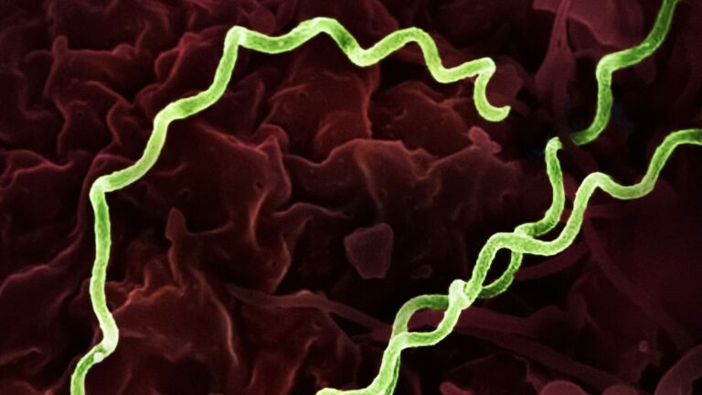 Colorized electron micrograph of Treponema pallidum, the bacteria that cause syphilis
