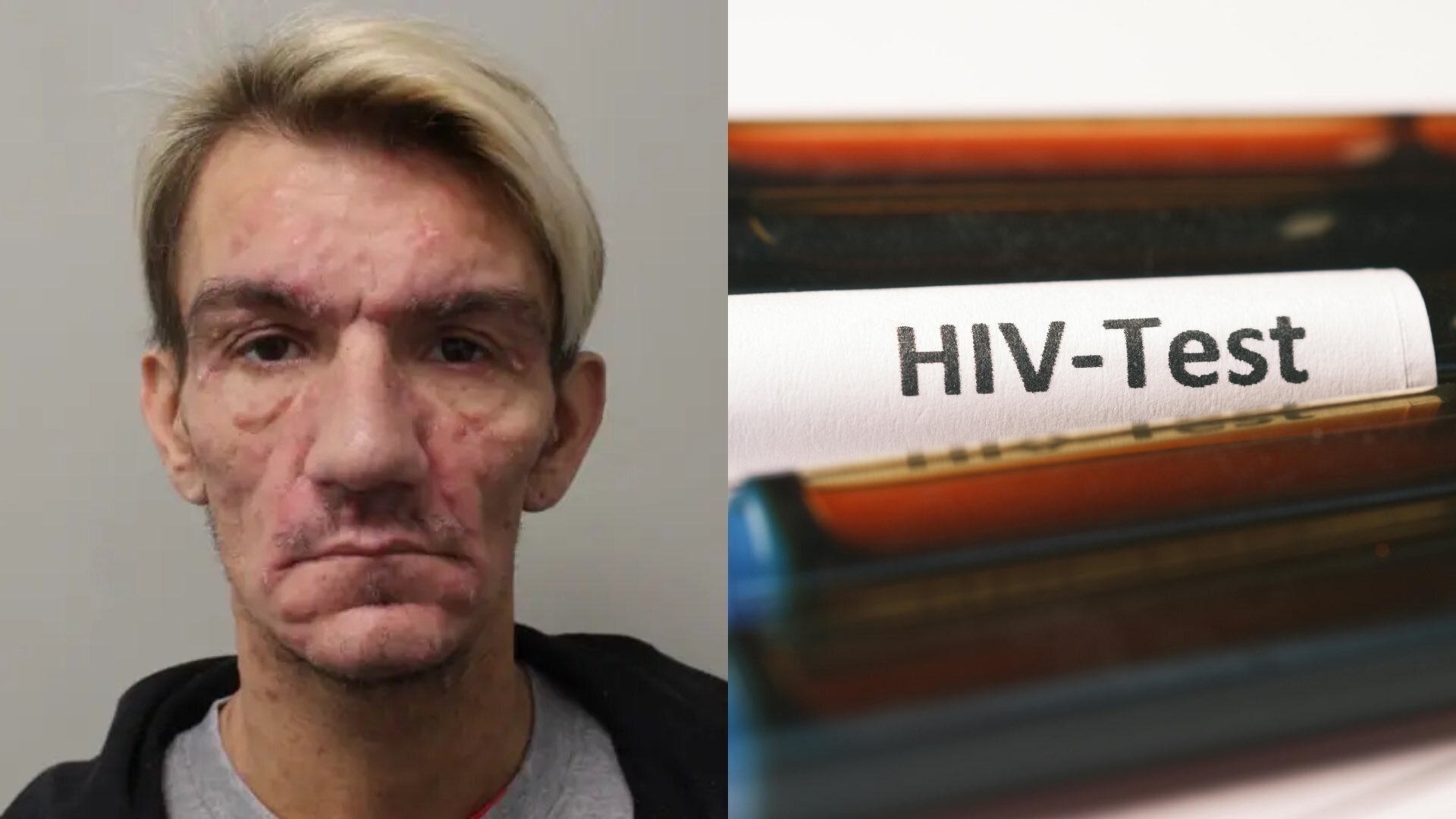 Jonathan Carl and HIV test stock image