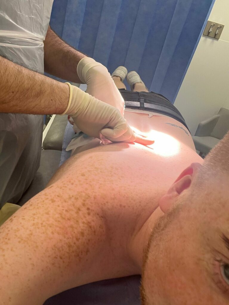 Luke Hamnett having his moles checked
